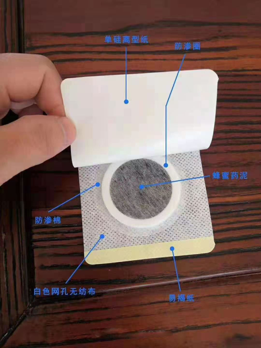 穴位壓力刺激貼。